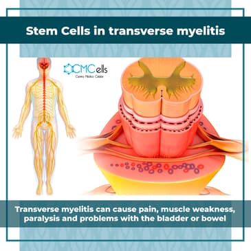 Slider image (2) Cmcells, Centro Medico Celular, (Stem Cells Medical Center)